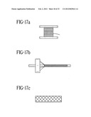 Stent-Graft with Bioabsorbable Structural Support diagram and image