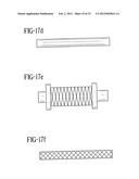 Stent-Graft with Bioabsorbable Structural Support diagram and image