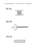 Stent-Graft with Bioabsorbable Structural Support diagram and image