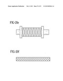 Stent-Graft with Bioabsorbable Structural Support diagram and image