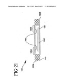 Stent-Graft with Bioabsorbable Structural Support diagram and image