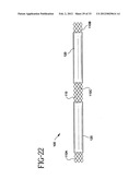 Stent-Graft with Bioabsorbable Structural Support diagram and image