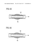 Stent-Graft with Bioabsorbable Structural Support diagram and image