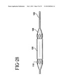 Stent-Graft with Bioabsorbable Structural Support diagram and image