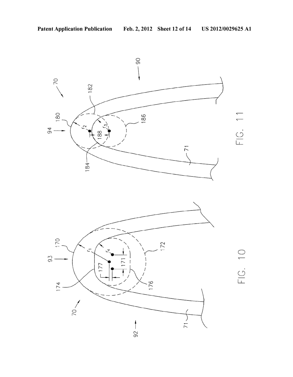 BARBED RADIALLY EXPANDABLE STENT - diagram, schematic, and image 13