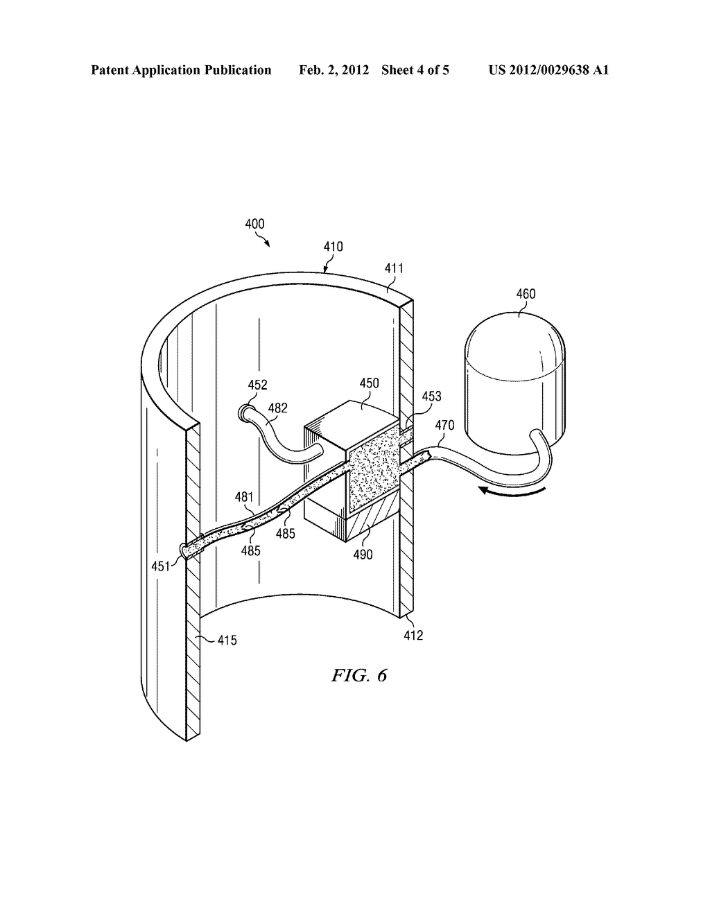 VERTEBRAL BODY REPLACEMENT DEVICE CONFIGURED TO DELIVER A THERAPEUTIC     SUBSTANCE - diagram, schematic, and image 05