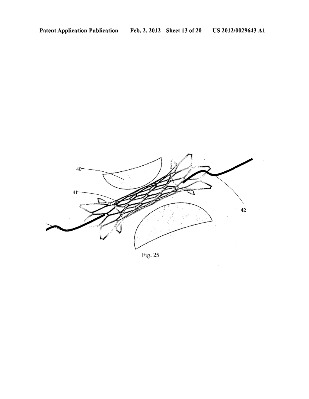 RESTORATIVE DEVICE - diagram, schematic, and image 14