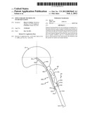 SPINE SURGERY METHOD AND INSTRUMENTATION diagram and image