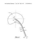 SPINE SURGERY METHOD AND INSTRUMENTATION diagram and image