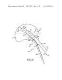 SPINE SURGERY METHOD AND INSTRUMENTATION diagram and image