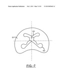 SPINE SURGERY METHOD AND INSTRUMENTATION diagram and image