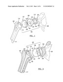 Shoulder Implant Assemby diagram and image