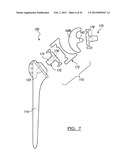 Shoulder Implant Assemby diagram and image