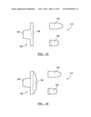 Shoulder Implant Assemby diagram and image