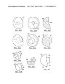 Shoulder Implant Assemby diagram and image