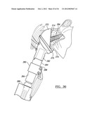 Shoulder Implant Assemby diagram and image