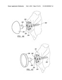 Shoulder Implant Assemby diagram and image