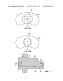 KNEE PROSTHESIS WITH ROTATABLE POST diagram and image