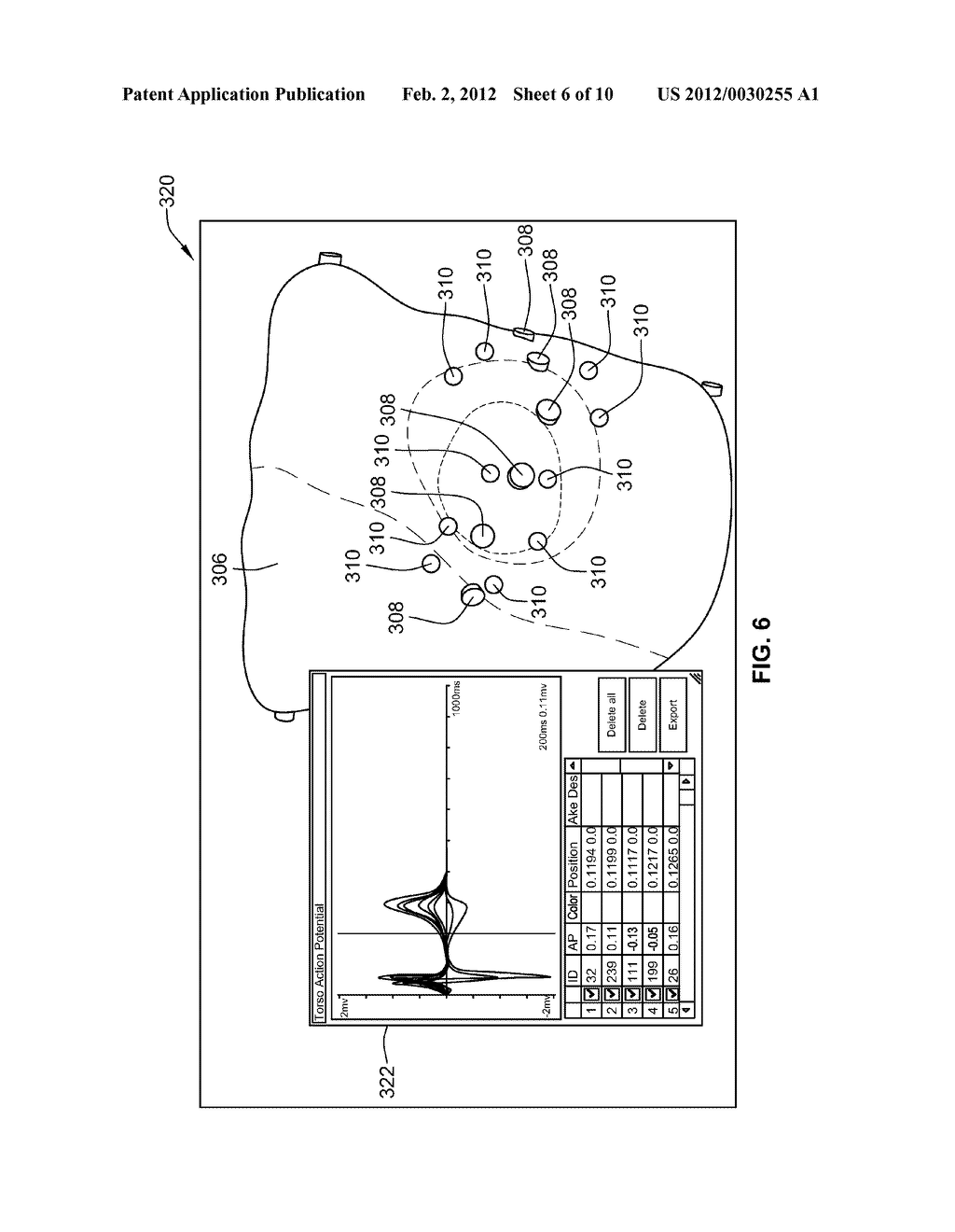 SYSTEMS AND METHODS FOR MODELING ELECTRICAL ACTIVITY OF AN ANATOMICAL     STRUCTURE - diagram, schematic, and image 07
