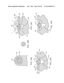 INFUSION PUMP SYSTEM WITH DISPOSABLE CARTRIDGE HAVING PRESSURE VENTING AND     PRESSURE FEEDBACK diagram and image