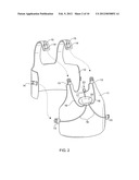 Multiple buckle release system diagram and image