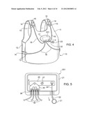 Multiple buckle release system diagram and image