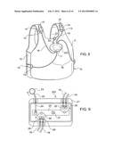 Multiple buckle release system diagram and image