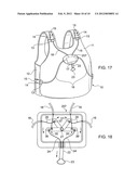 Multiple buckle release system diagram and image