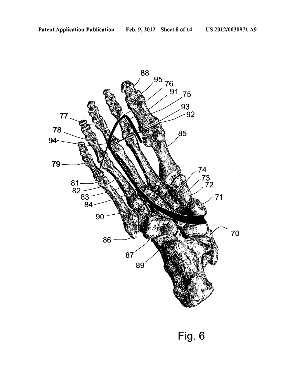 SOLE FOR A SHOE, IN PARTICULAR FOR A RUNNING SHOE - diagram, schematic, and image 09