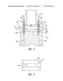 GROUND ANCHOR ASSEMBLY diagram and image