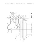 CRICOID MANIPULATING APPARATUS FOR ANESTHESIA ASSISTANCE AND TRACHEAL     INTUBATION diagram and image