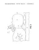 CRICOID MANIPULATING APPARATUS FOR ANESTHESIA ASSISTANCE AND TRACHEAL     INTUBATION diagram and image