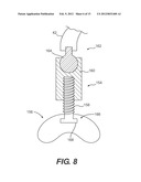 CRICOID MANIPULATING APPARATUS FOR ANESTHESIA ASSISTANCE AND TRACHEAL     INTUBATION diagram and image