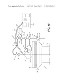 CRICOID MANIPULATING APPARATUS FOR ANESTHESIA ASSISTANCE AND TRACHEAL     INTUBATION diagram and image