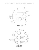 CRICOID MANIPULATING APPARATUS FOR ANESTHESIA ASSISTANCE AND TRACHEAL     INTUBATION diagram and image