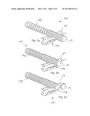 Cleaning Apparatus For Use With Dentures And Other Dental Appliances diagram and image