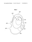 Pre-Crash Side Air Bag Device diagram and image