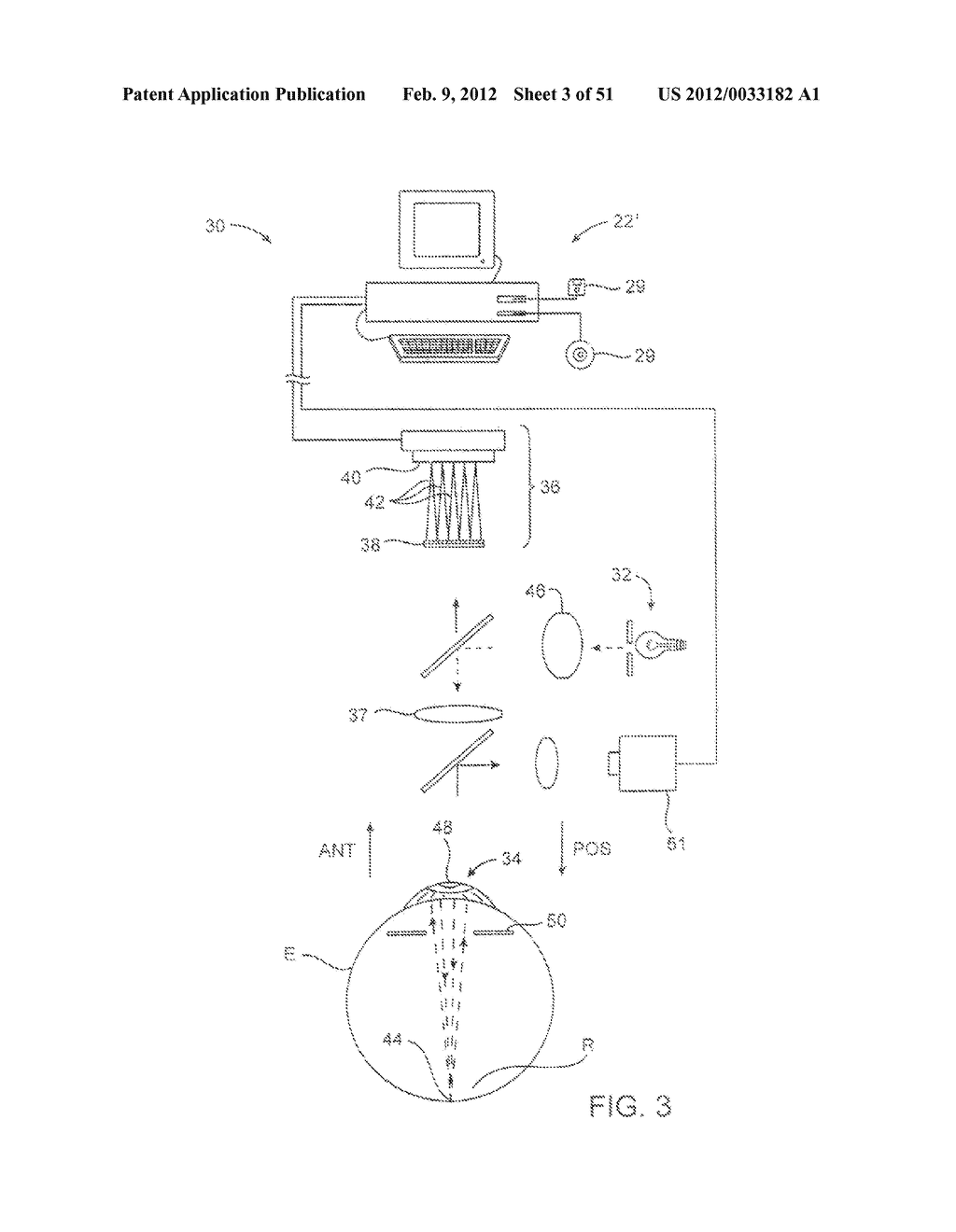 COMPOUND MODULATION TRANSFER FUNCTION FOR LASER SURGERY AND OTHER OPTICAL     APPLICATIONS - diagram, schematic, and image 04