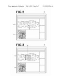 DIAGNOSIS ASSISTING APPARATUS, DIAGNOSIS ASSISTING METHOD, AND RECORDING     MEDIUM HAVING A DIAGNOSIS ASSISTING PROGRAM STORED THEREIN diagram and image