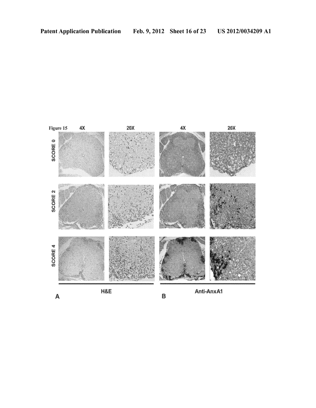 Treatment - diagram, schematic, and image 17