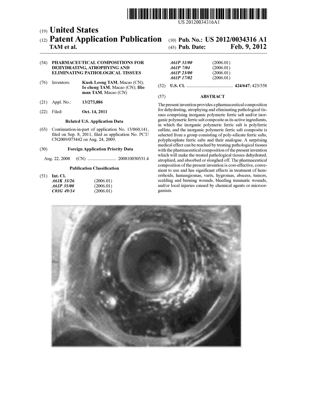 PHARMACEUTICAL COMPOSITIONS FOR DEHYDRATING, ATROPHYING AND ELIMINATING     PATHOLOGICAL TISSUES - diagram, schematic, and image 01