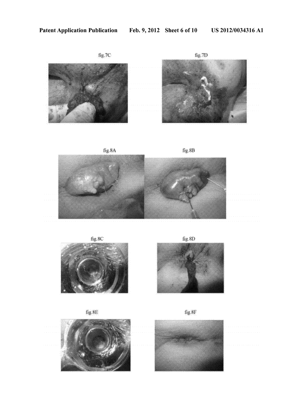 PHARMACEUTICAL COMPOSITIONS FOR DEHYDRATING, ATROPHYING AND ELIMINATING     PATHOLOGICAL TISSUES - diagram, schematic, and image 07