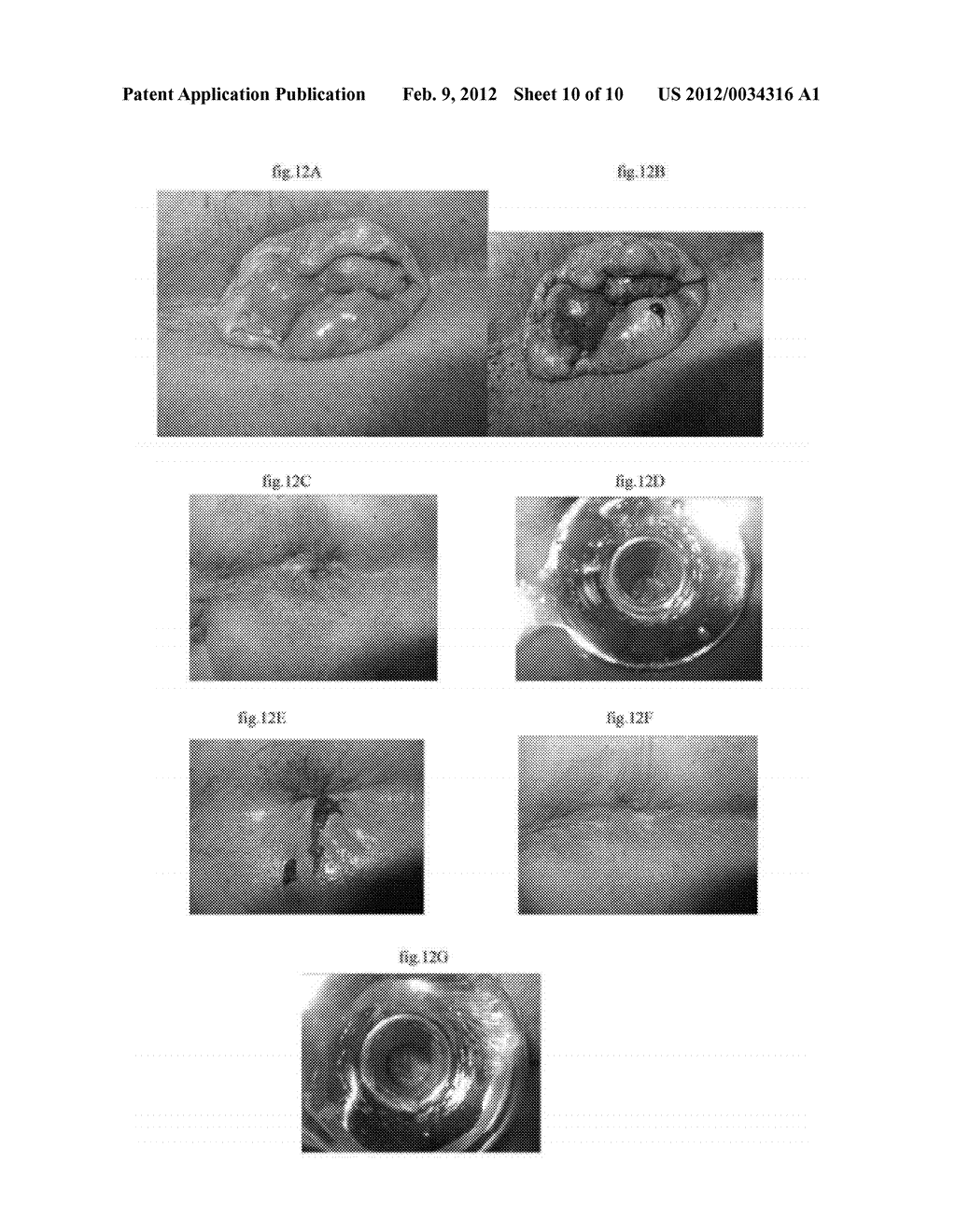 PHARMACEUTICAL COMPOSITIONS FOR DEHYDRATING, ATROPHYING AND ELIMINATING     PATHOLOGICAL TISSUES - diagram, schematic, and image 11