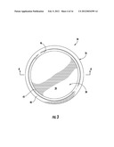 Injection-Molded Composite Container diagram and image