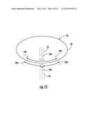 Injection-Molded Composite Container diagram and image