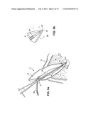 APPARATUS FOR EVACUATION OF ROOT CANAL diagram and image