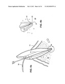 APPARATUS FOR EVACUATION OF ROOT CANAL diagram and image