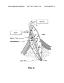 APPARATUS FOR EVACUATION OF ROOT CANAL diagram and image