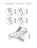 APPARATUS FOR EVACUATION OF ROOT CANAL diagram and image