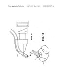 APPARATUS FOR EVACUATION OF ROOT CANAL diagram and image